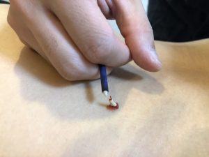 点灸